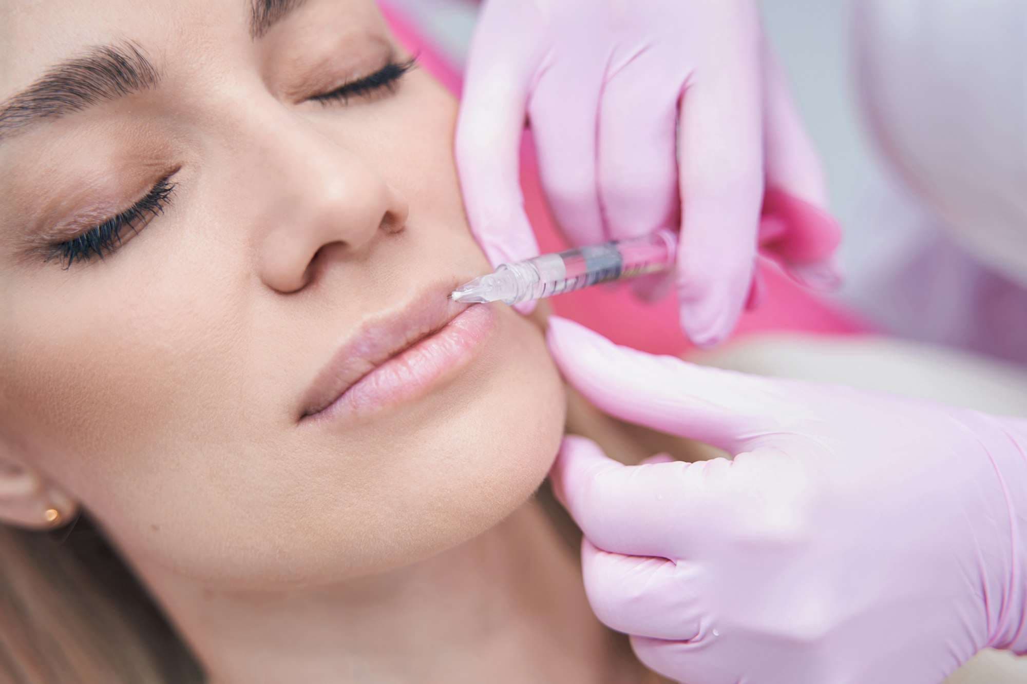 Patient receiving precise lip filler injection