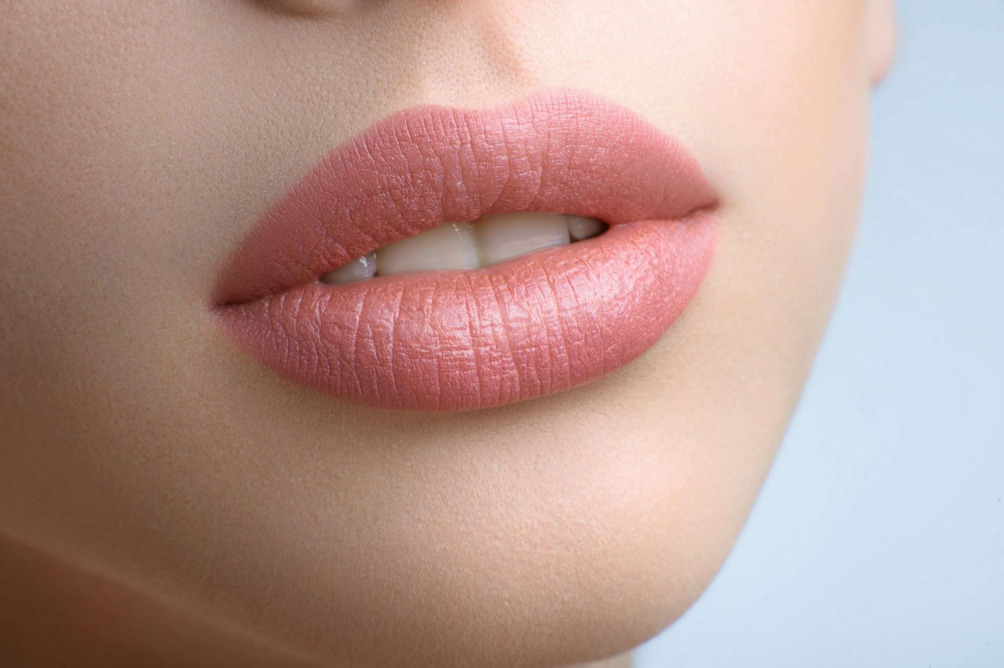 Naturally full lips after expert lip filler treatment
