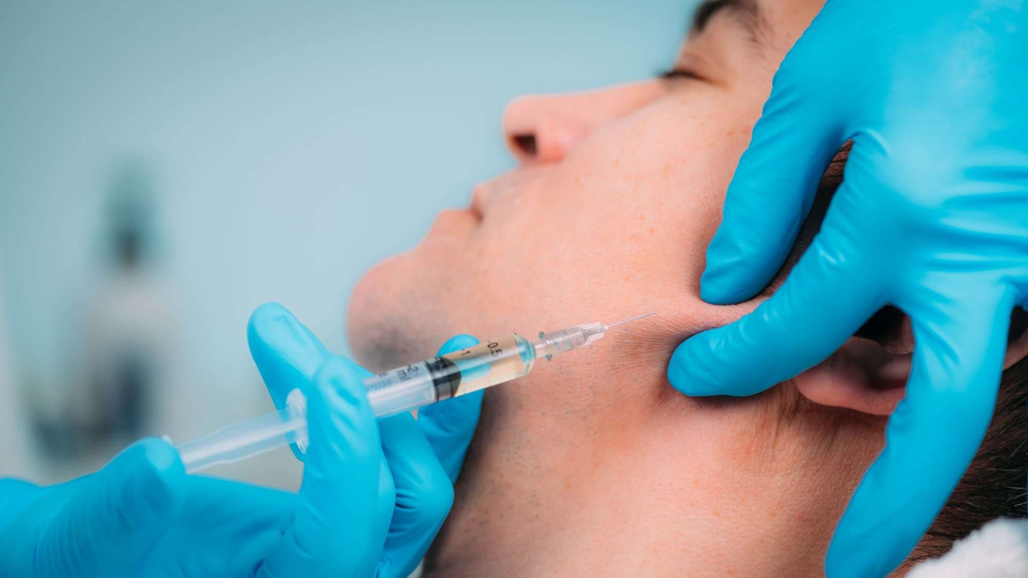 Man receiving jawline dermal filler injection for definition