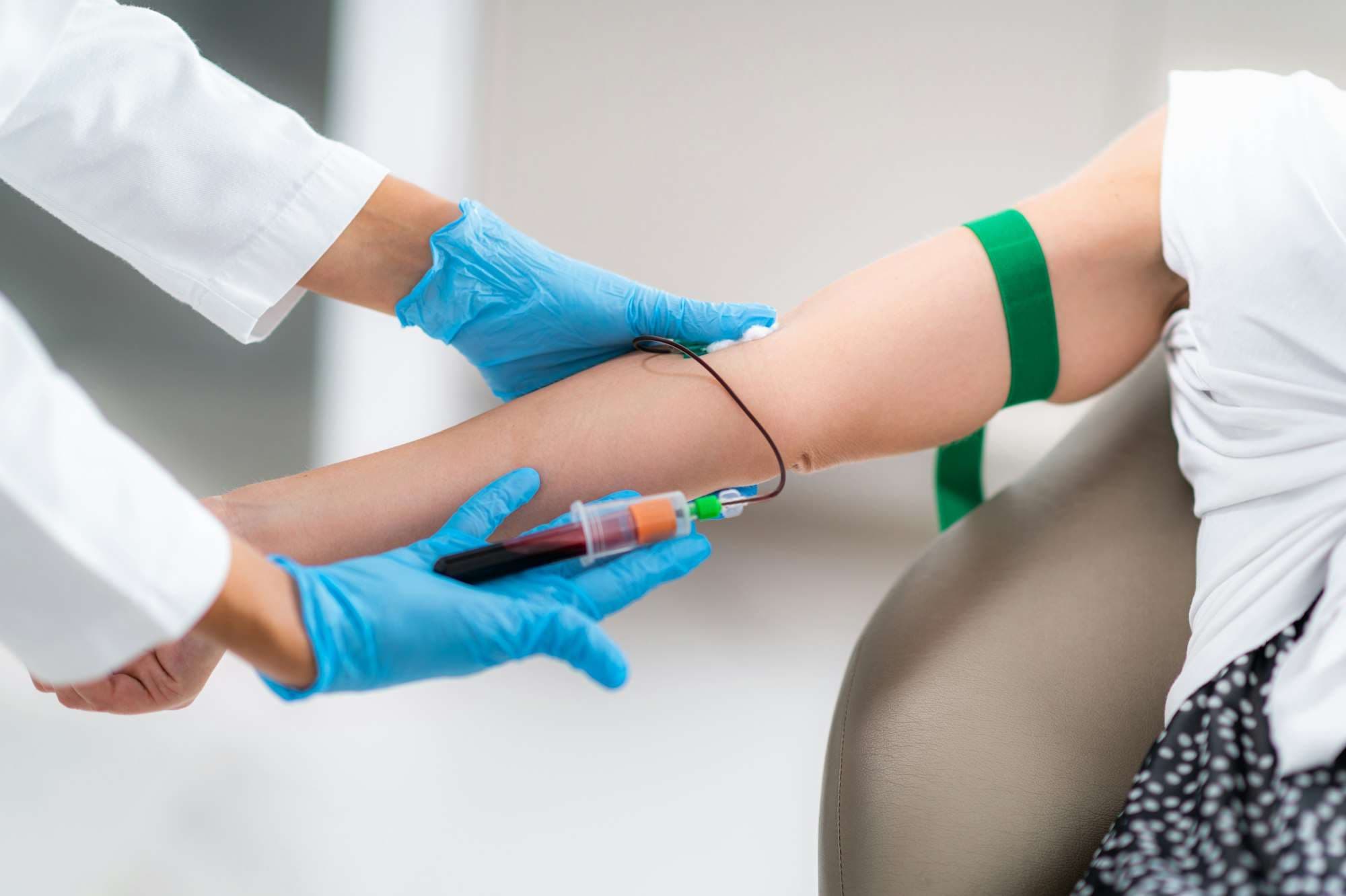 Treatment specialist preparing platelet-rich plasma treatment