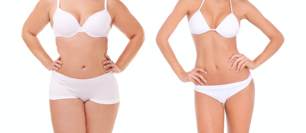 Fit for Summer. Cropped before and after shot of a womans weight loss.